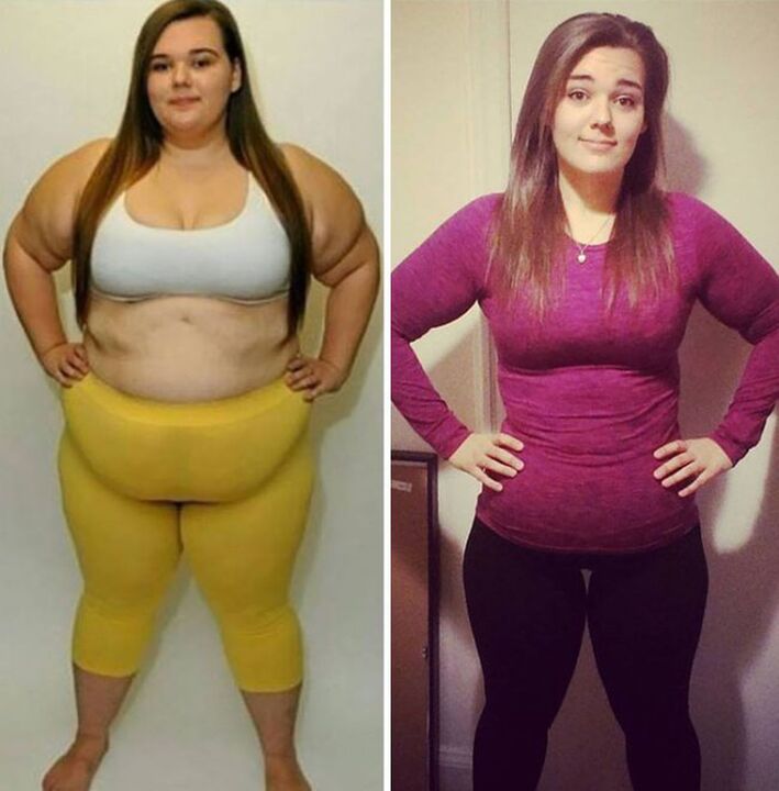 antes y después de perder peso con Dietoll